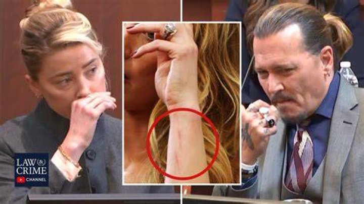 
Amber Heard Scars On Red Carpet Explained: Did Johnny Depp Attack Her? 