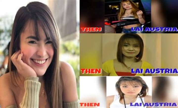 Did Lai Austria Get Plastic Surgery? Before & After Pictures Of The Model