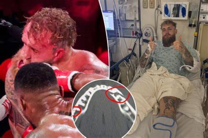 
Did Tom Browning Health And Injury Cause His Death? Broken Arm Update 